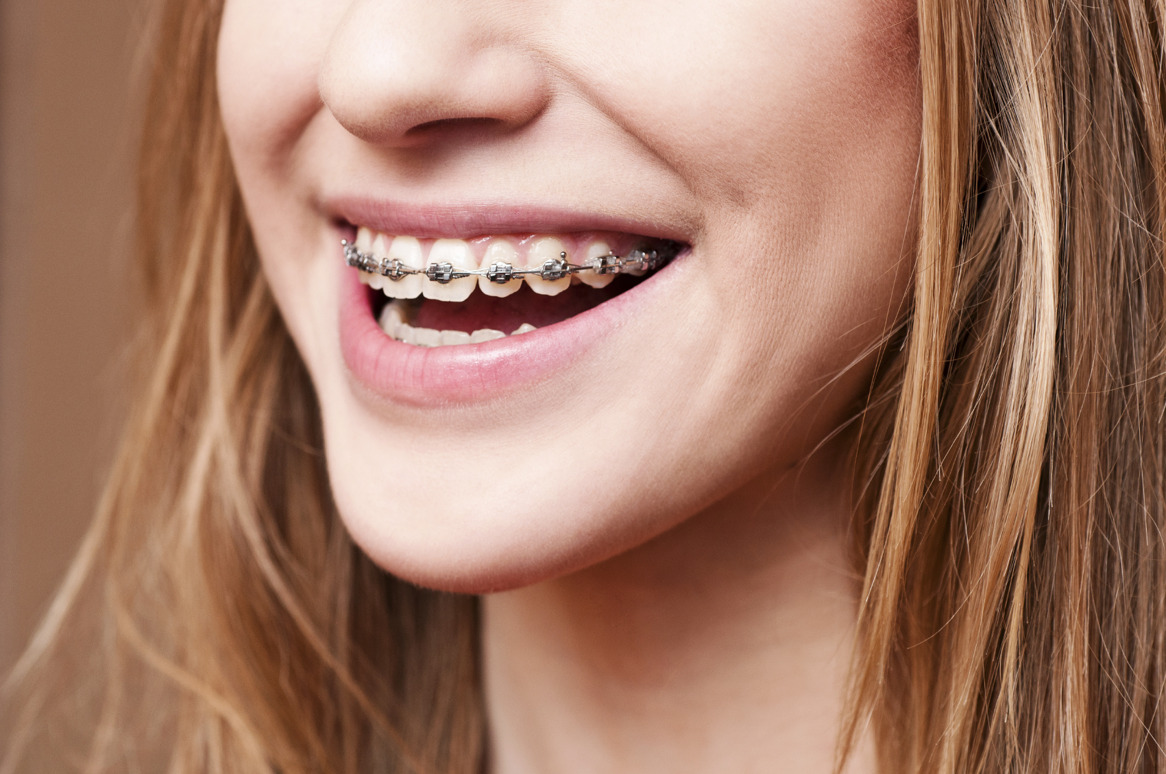 Easy Steps for a Successful Orthodontic Treatment